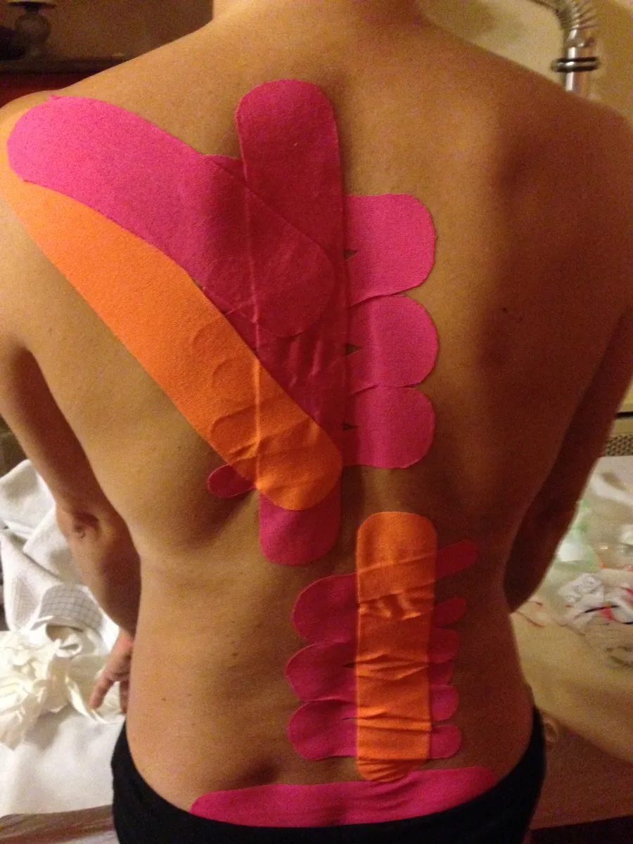 Kinezio tape - kezelések kiegészítő eszköze